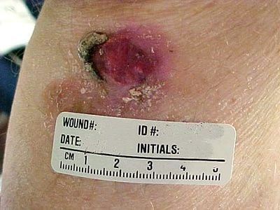 basal.jpg