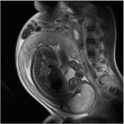 mri-20scan.jpg