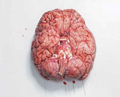 brain2.jpg