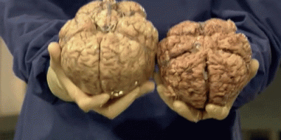 brian-20compare-20-281-29.gif