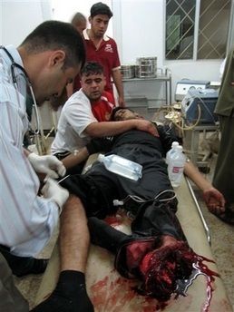 man_loses_leg.jpg