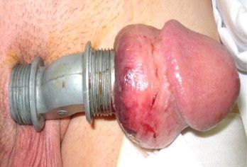 Name:  in1.jpg
Views: 383440
Size:  31.5 KB
