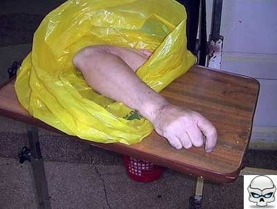Severed-arm.jpg