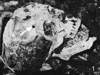 Name:  skull.jpg
Views: 1319
Size:  42.7 KB