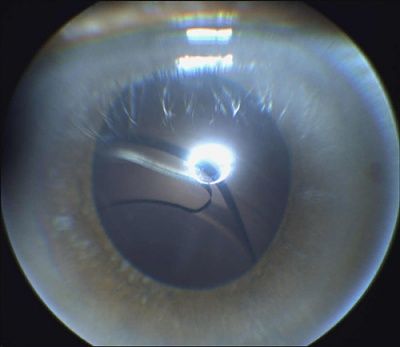 retina.jpg