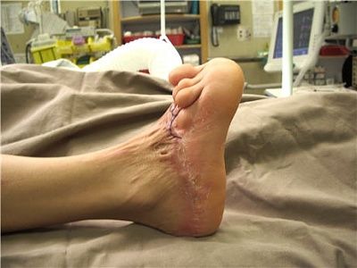 foot.jpg