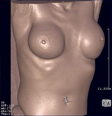 tits.jpg