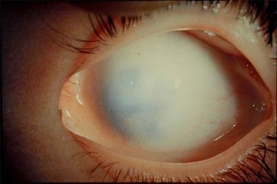 eyeye.jpg