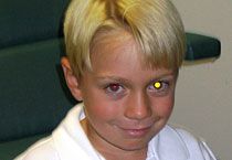 webber-glow-eye-cancer-210x145.jpg