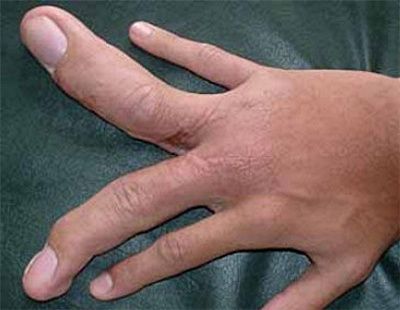big-20fingers.jpg