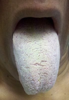 tongue.jpg