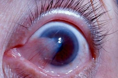 skin-20eye.jpg