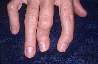 4453-13248-30956-31495.jpg