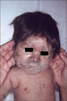 hairy.jpg