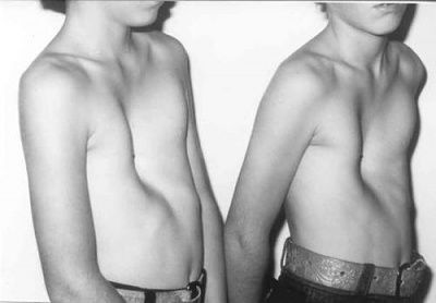 pec.jpg