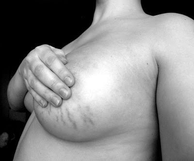 breasttimeline12.jpg