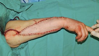hand-20trans-20-282-29.jpg