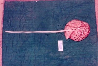 brain-20with-20spinal-20cord-20still-20attached.jpg