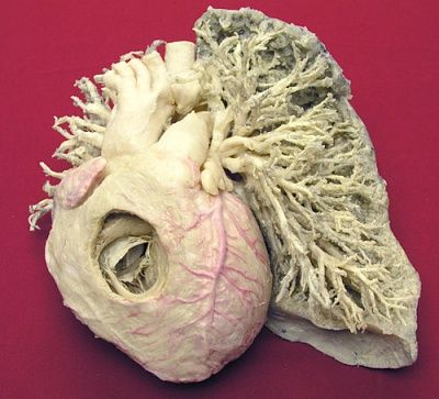 plastinated-20heart-20and-20lung..jpg