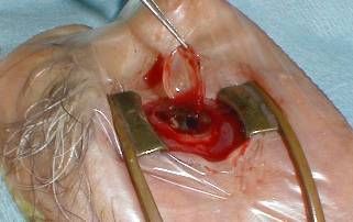 Eye%20Removal%203.jpg
