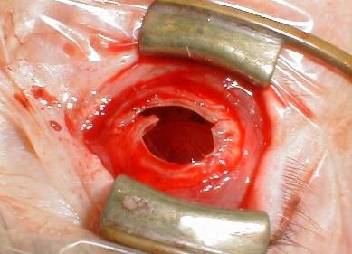 Eye%20Removal%207.jpg