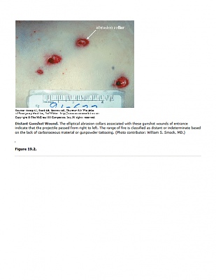 gun-20shot-20wound-2001.png