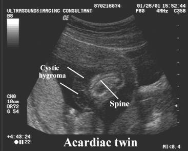 Acrania-06.jpg