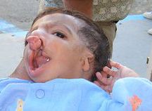 Deformity%2012.jpg