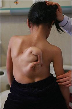 Parasitic%20Twin%2004.jpg