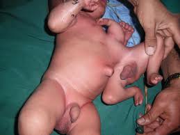 Parasitic%20Twin%2009.jpg