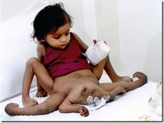 Parasitic%20Twin%2011.jpg