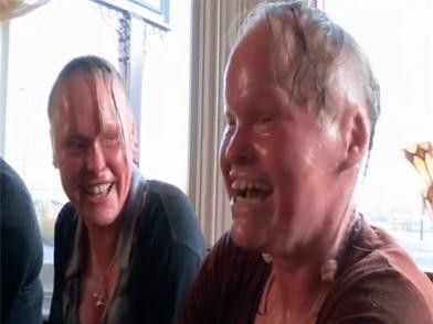 Harlequin-Ichthyosis%2013.jpg