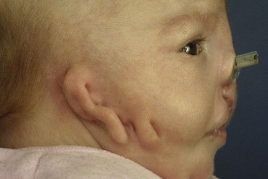 Deformities%2007.jpg