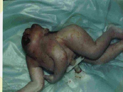 Deformities%2028.jpg
