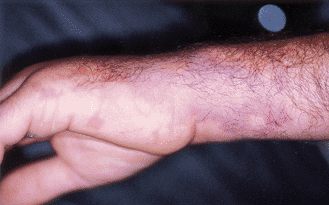 Giudice_2004_fig4.gif