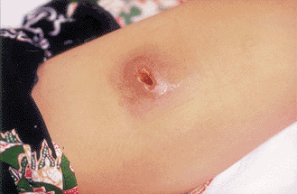 Giudice_2004_fig2.gif