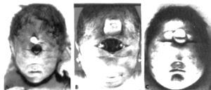 Cyclops%2008.jpg