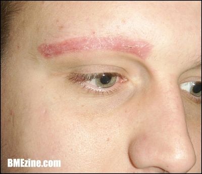 noeyebrow2.jpg