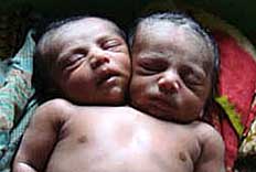 Two-faced-baby%2002.jpg