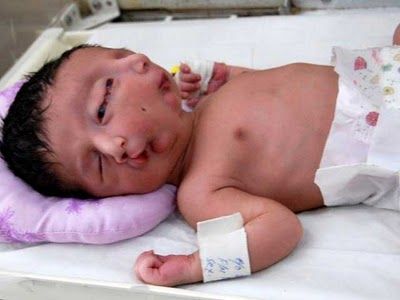 Two-faced-baby.jpg