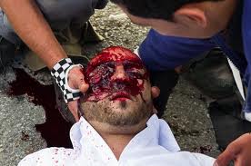 Palestinian-Mustafa-Tamimi-dies-from-tear-gas.jpg