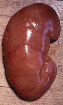 Name:  Normal_kidney.jpg
Views: 2899
Size:  41.7 KB