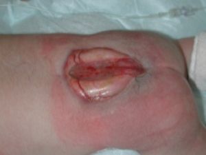 Name:  ImageUploadedByTapatalk 21364212972.439243.jpg
Views: 177
Size:  50.8 KB