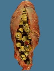 stones.jpg