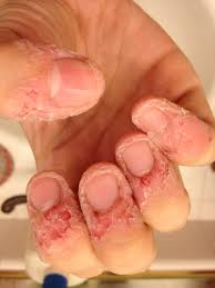 fingers2.jpg