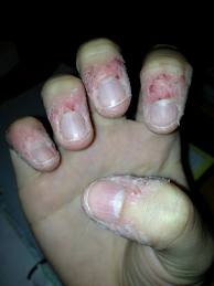 fingers.jpg