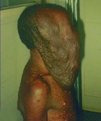 scrotum-20face.jpg