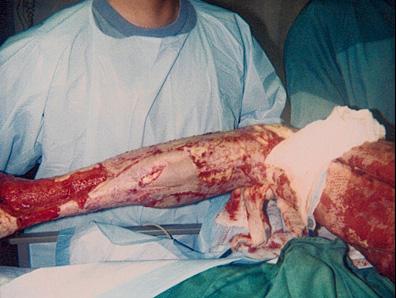 ankle2.jpg