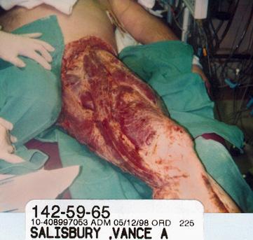 leg1.jpg
