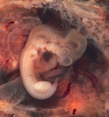 human-20embryo-20at-207-20weeks.jpg